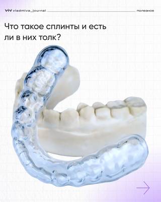 Сплинты при патологиях ВНЧС — доказанная эффективность.